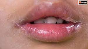 health news lips care tips lips