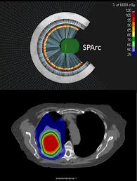 daily treatment with proton arc therapy