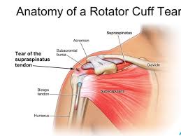 Shoulder anatomy is an elegant piece of machinery having the greatest range of motion of any joint in the body. Krv Neck And Shoulder Pain Treatment In India Shoulder Pain Doctors
