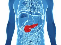 Learn about the signs and symptoms of pancreatic cancer, including, but not limited to: Pancreatic Cancer Causes Symptoms Prognosis And Treatments