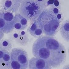 Of the cytokinetic apparatus, a complex ing plant cells, both at the light and the electron microscope level of analysis. Microscope Images Of Cytokinesis Blocked Lymphocytes On Microarray Cd2 Download Scientific Diagram