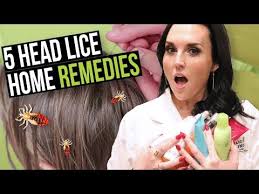 top 5 home remes for head lice