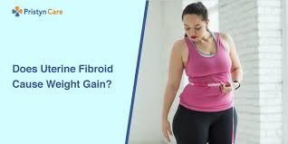 does uterine fibroid cause weight gain