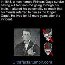 Case study of phineas gage   YouTube Phineas Gage s Astonishing Brain Injury