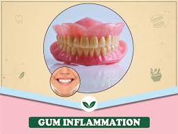 effective home remes for healthy gums