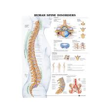 Anatomical Chart Human Spine Disorders
