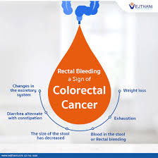 Colon cancer and rectal cancer (also called colorectal cancer) are common in the uk. Blood In The Stool A Sign Of Colorectal Cancer Vejthani Hospital Jci Accredited International Hospital In Bangkok Thailand