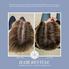 pilot study supports hair revival