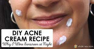 diy acne cream homemade acne treatment