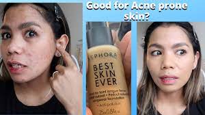 um tan skin acne e skin