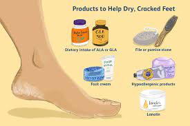 dry ed feet causes and remes