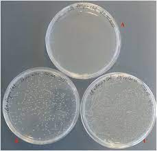 1 500 w v lb agar plates containing