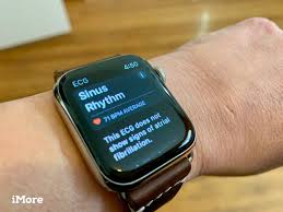 Ecg Apple Watch App The Ultimate Guide Imore