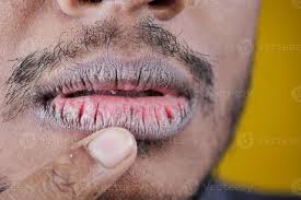 young men hand dry lips 21606773