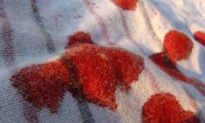 If you answered positively to the above questions, then rubbing alcohol is one of the best home remedies to remove the stains of a permanent marker as it dissolves the ink effectively. Bold Tips For Removing Blood Stains From Fabric Smart Tips