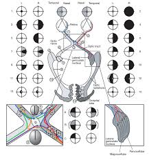 Visual Field Lesions Optometry School Neurology Eye Anatomy