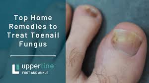 top home remes to treat toenail fungus