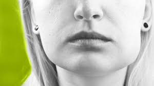 Cheek — ist der familienname folgender personen: Swollen Cheek Is It Serious Causes Diagnosis And Treatment