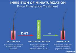 P., bak h., sim w. Dht The Hair Killer Gl Perrault Md Hair Loss And Hair Restoration