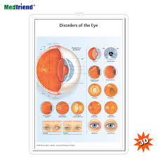 Licensed Educational Plastic 3d Medical Anatomical Wall Chart Poster Disorders Of The Eye Buy Medical Paper 3d Pvc Eye Disorders Embossed Medical