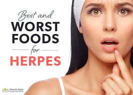 Best And Worst Foods For Herpes