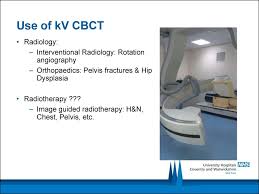 implementation of cone beam ct imaging