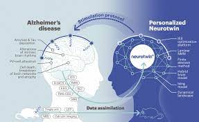 Alzheimer disease is characterized by a progressive and irreversible decline in memory and deterioration of other cognitive abilities. Neurotwin Proposes A Novel Therapy For Alzheimer S Disease Horizon 2020