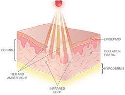 led light therapy transforms your skin