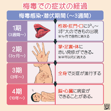 梅毒とは？原因・症状・検査・治療など | 新宿駅前クリニック泌尿器科