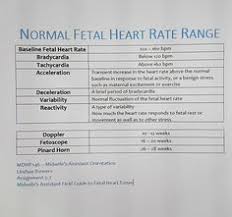 8 Best Fetal Heart Monitoring Images Fetal Heart