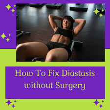 fix diastasis recti without surgery