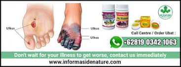 Obat untuk luka kencing manis, obat herbal luka diabetes. Ubat Diabetes Yang Paling Berkesan Di Farmasi Di Malaysia Ubat Kencing Manis