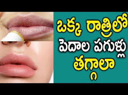 home remes for chapped lips