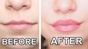 get bigger lips naturally