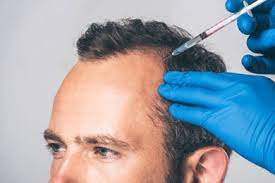 does stem cell therapy work on hair loss