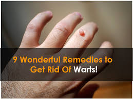 wonderful remes to get rid of warts
