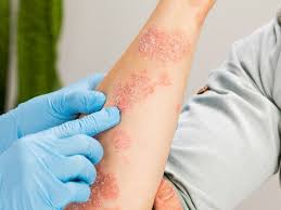 how can you tell if a skin rash is
