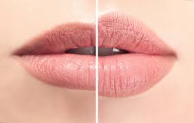 best lip surgery in kolkata