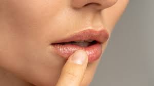 how to get rid of chapped lips these 7