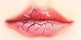 advice from ent doctors dry mouth