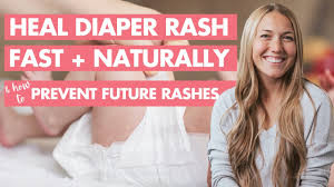 fast natural diaper rash treatment