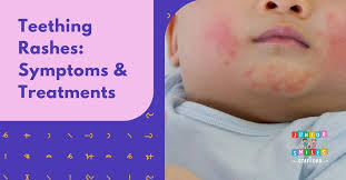 teething rashes symptoms and