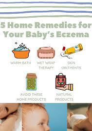 5 home remes for your baby s eczema