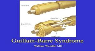 Published online 15 july 2014; Download Free Medical About Guillain Barre Syndrome Powerpoint Presentation