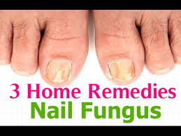 home remes for nail fungus infection