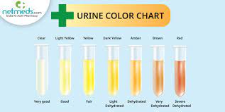 diffe colours of urine know what