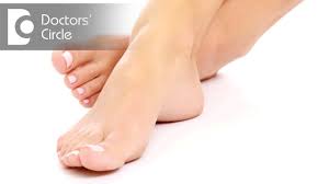 how to remove dark spots on feet dr