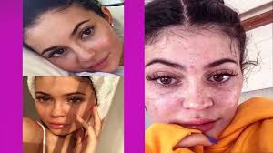 how kylie jenner before and after look