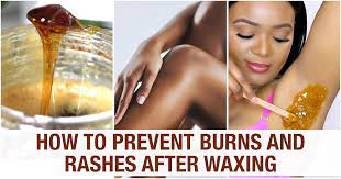 how to heal burn spots after waxing