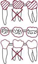 12 The Dental Examination Pocket Dentistry